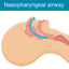 Nasal Airway Kit 7MM – Emergency Nasopharyngeal Airway for First Aid & Trauma Response - ASA TECHMED